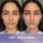 Shark Hydroaktywny system pielęgnacji twarzy FacialPro Glow FH320E - 1568664 - zdjęcie 3